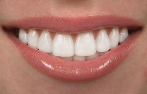 Restorative Dentistry West Miami, FL